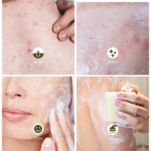 Cargar imagen en el visor de la galería, Higiene - Jabón piel grasa